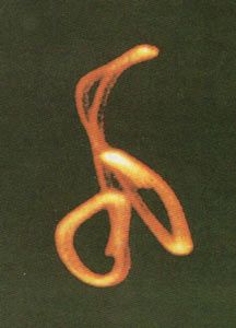 LHASEK